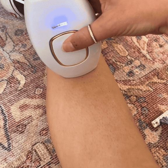 SmoothSkin Laser Hair Remover