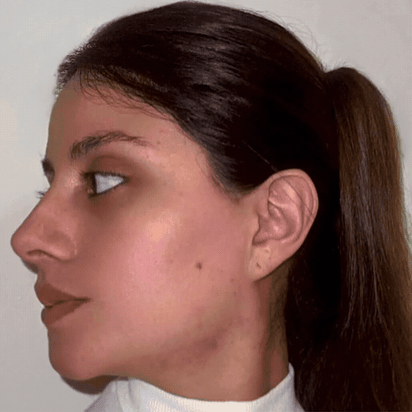 RadiantGlow™ LED Facial Therapy Mask