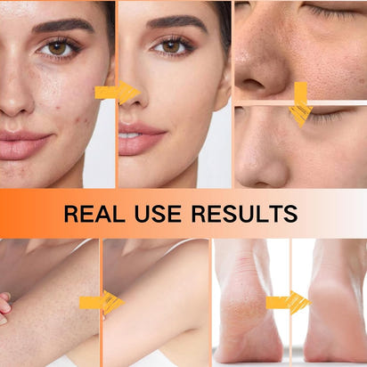 Exfoliating Kojic Acid Turmeric Mist