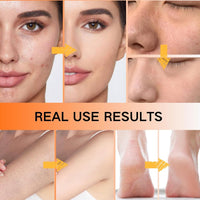 Exfoliating Kojic Acid Turmeric Mist