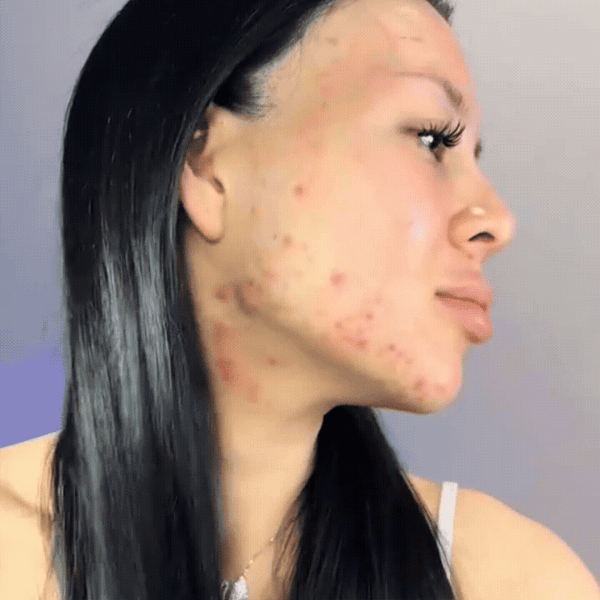 Radiant Skin Relief Cream