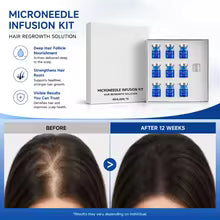 Microneedle Hair Regrowth Kit Solution Scalp Nourishing Serum For Hair Health Maintenance Needle Head Use Scalp Care Kit