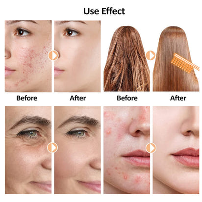 Radiant Glow Electrotherapy Wand