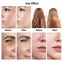 Radiant Glow Electrotherapy Wand