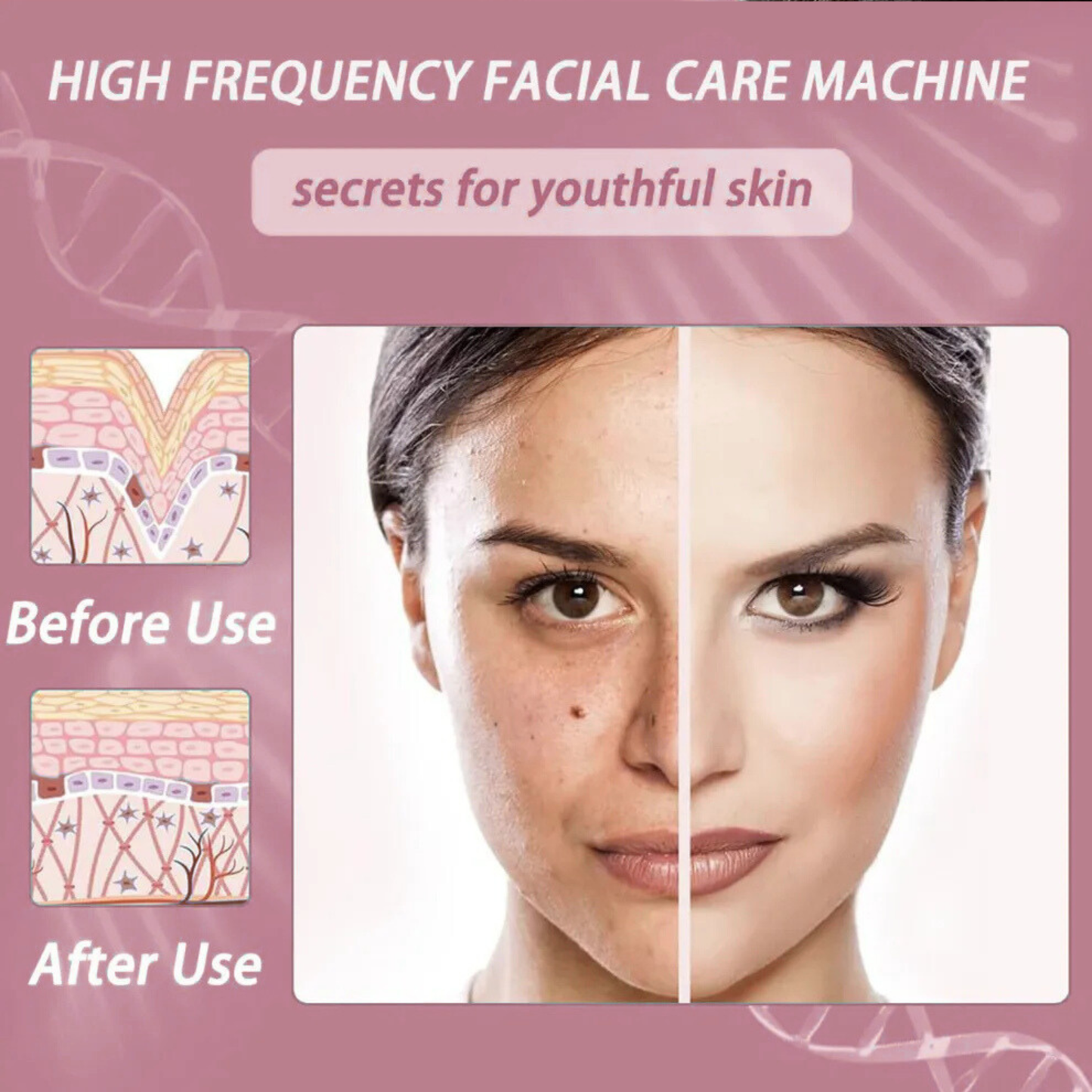 Radiant Glow Electrotherapy Wand